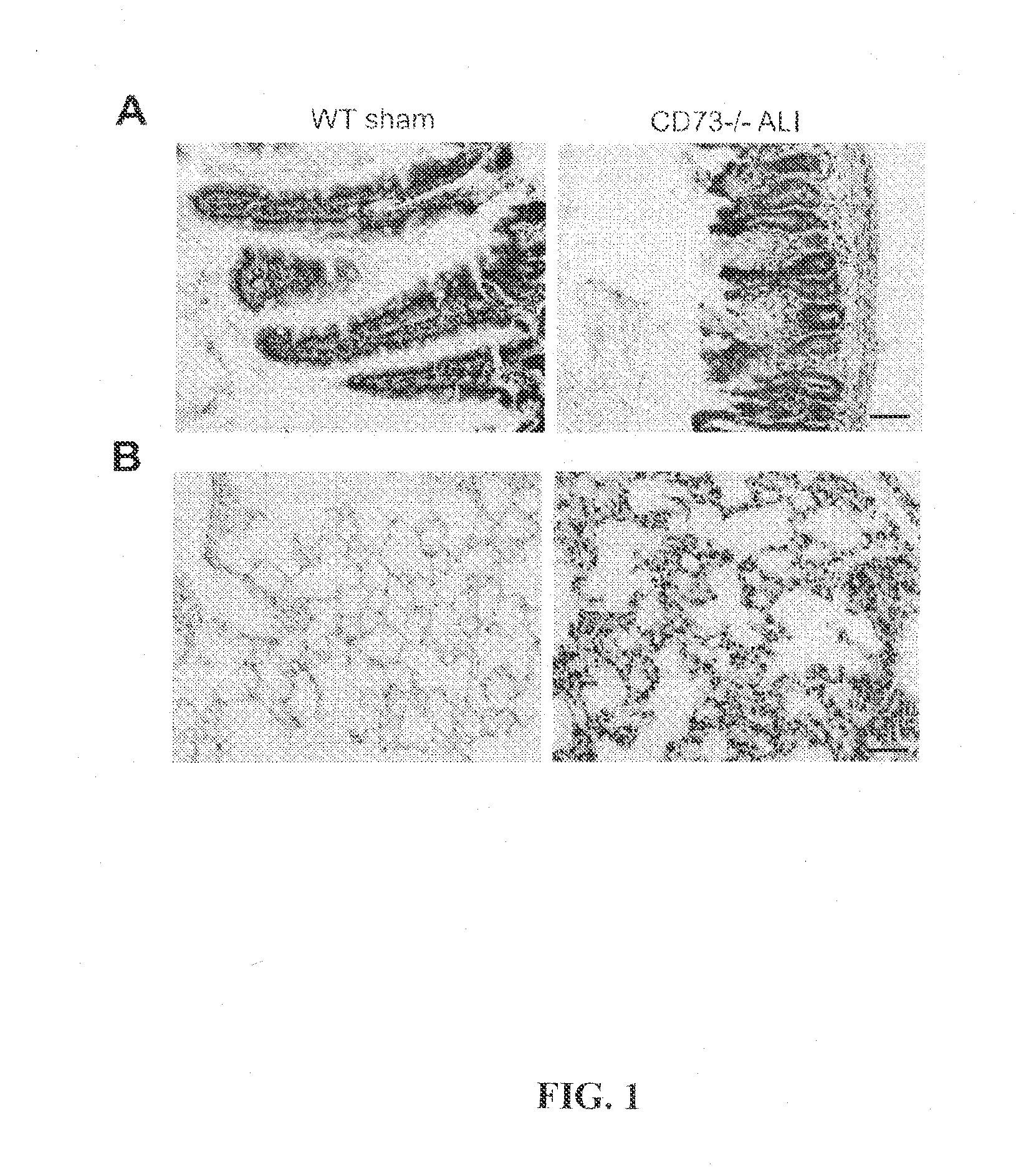 Biomarker for monitoring development of diseases and assessing the efficacy of therapies