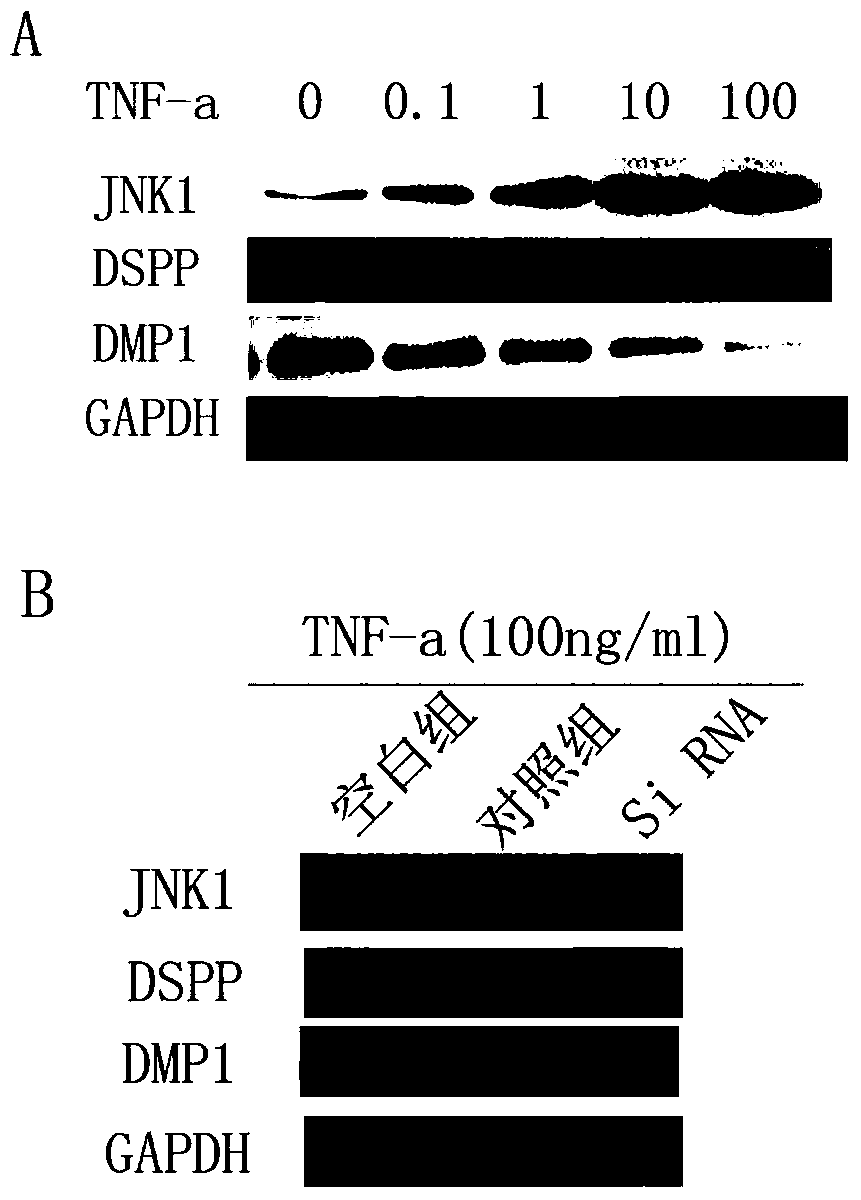 Small interfering RNA targeting human jnk1 gene and its application