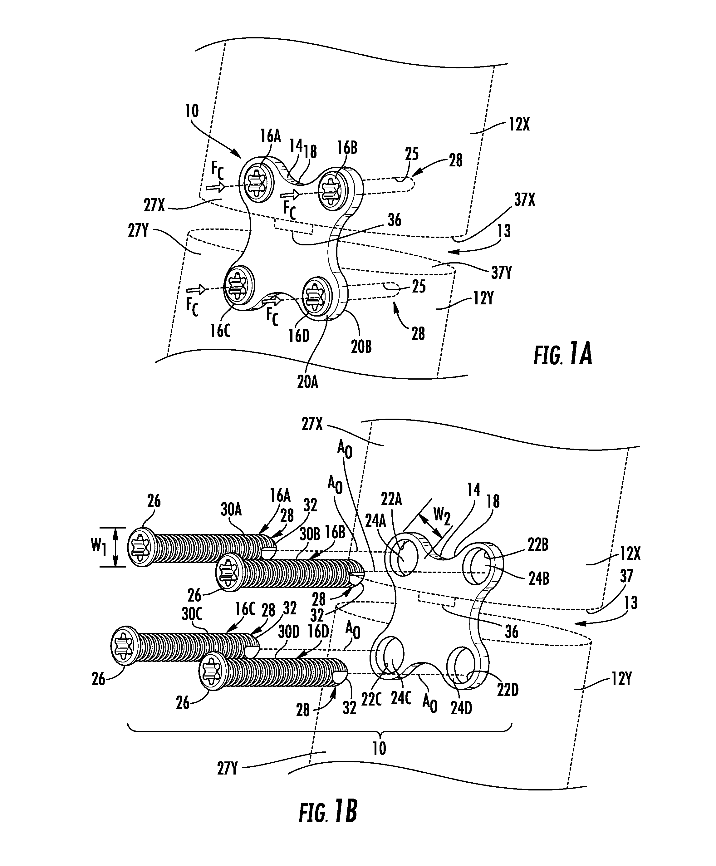 Anterior Cervical Plates For Spinal Surgery Employing Anchor Blackout Prevention Devices, And Related Systems And Methods