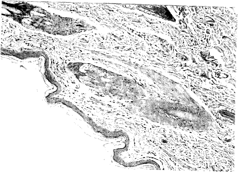 External medicinal composition for treating skin ulcer and preparation method thereof