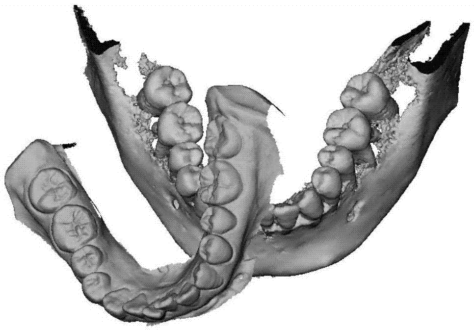Dentition model generation method based on oral cavity scanning data and CBCT (Cone Beam Computed Tomography) data