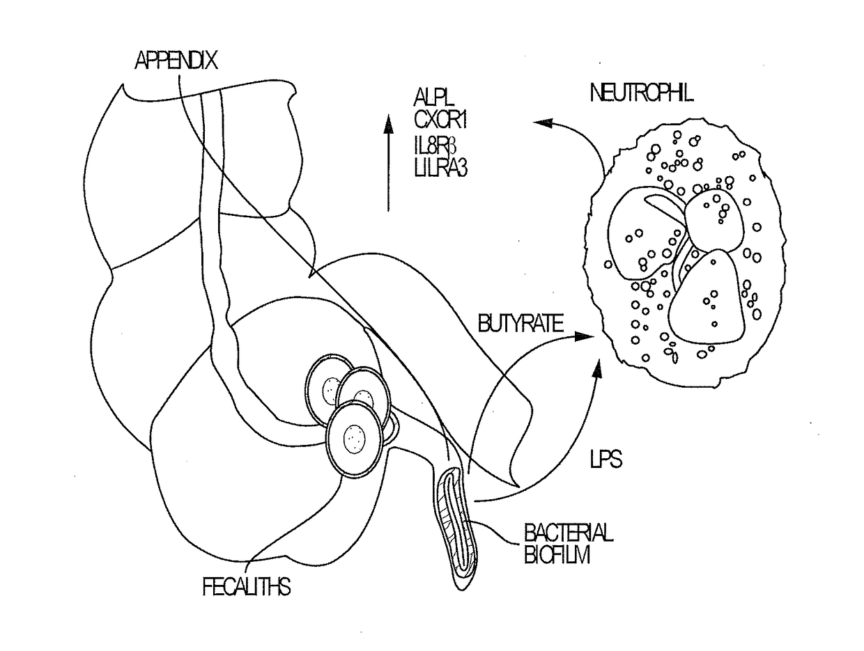 Blood biomarkers for appendicitis and diagnostics methods using biomarkers