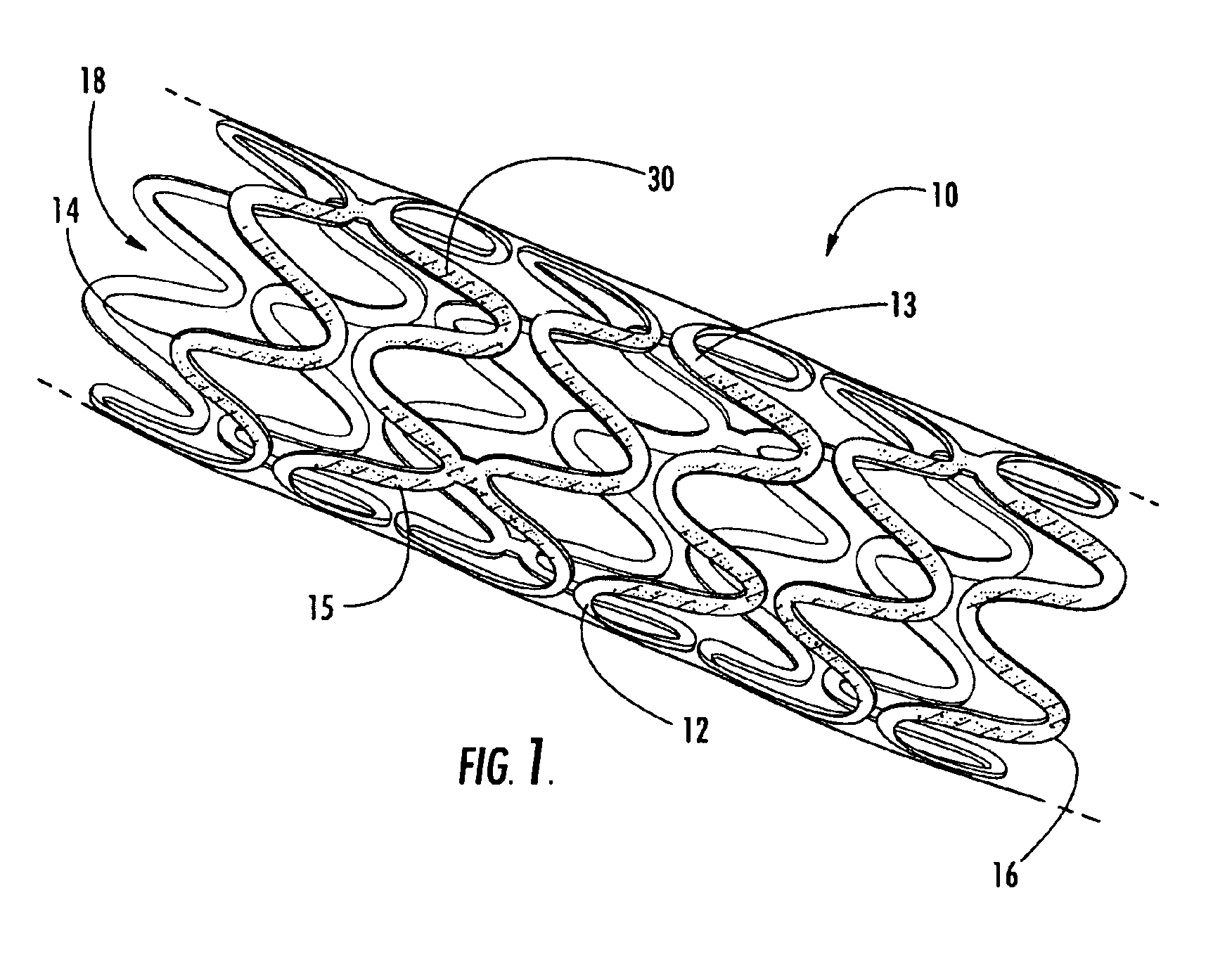 Intraluminal prostheses having polymeric material with selectively modified crystallinity and methods of making same