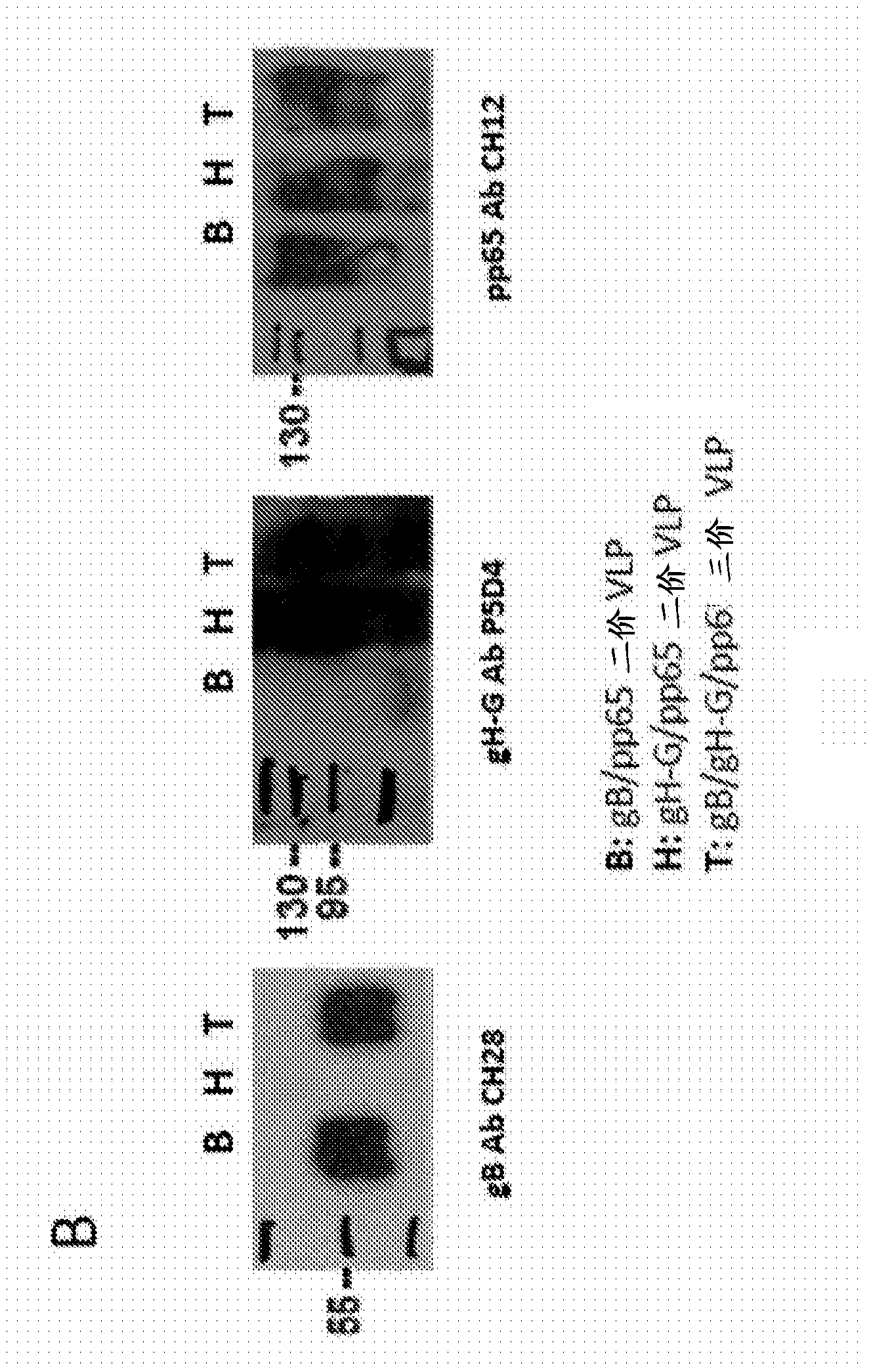 Compositions and methods for treatment of cytomegalovirus