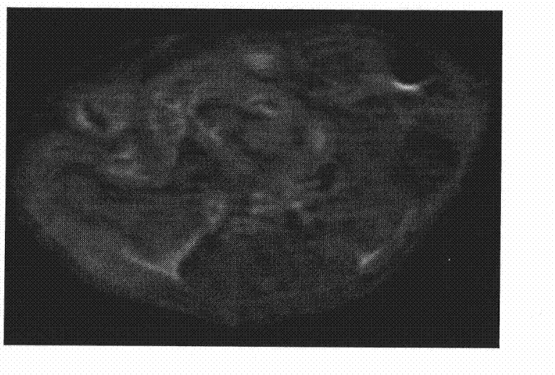 Lipid nano granule containing magnetic resonance contrast agent as well as preparation method and use thereof