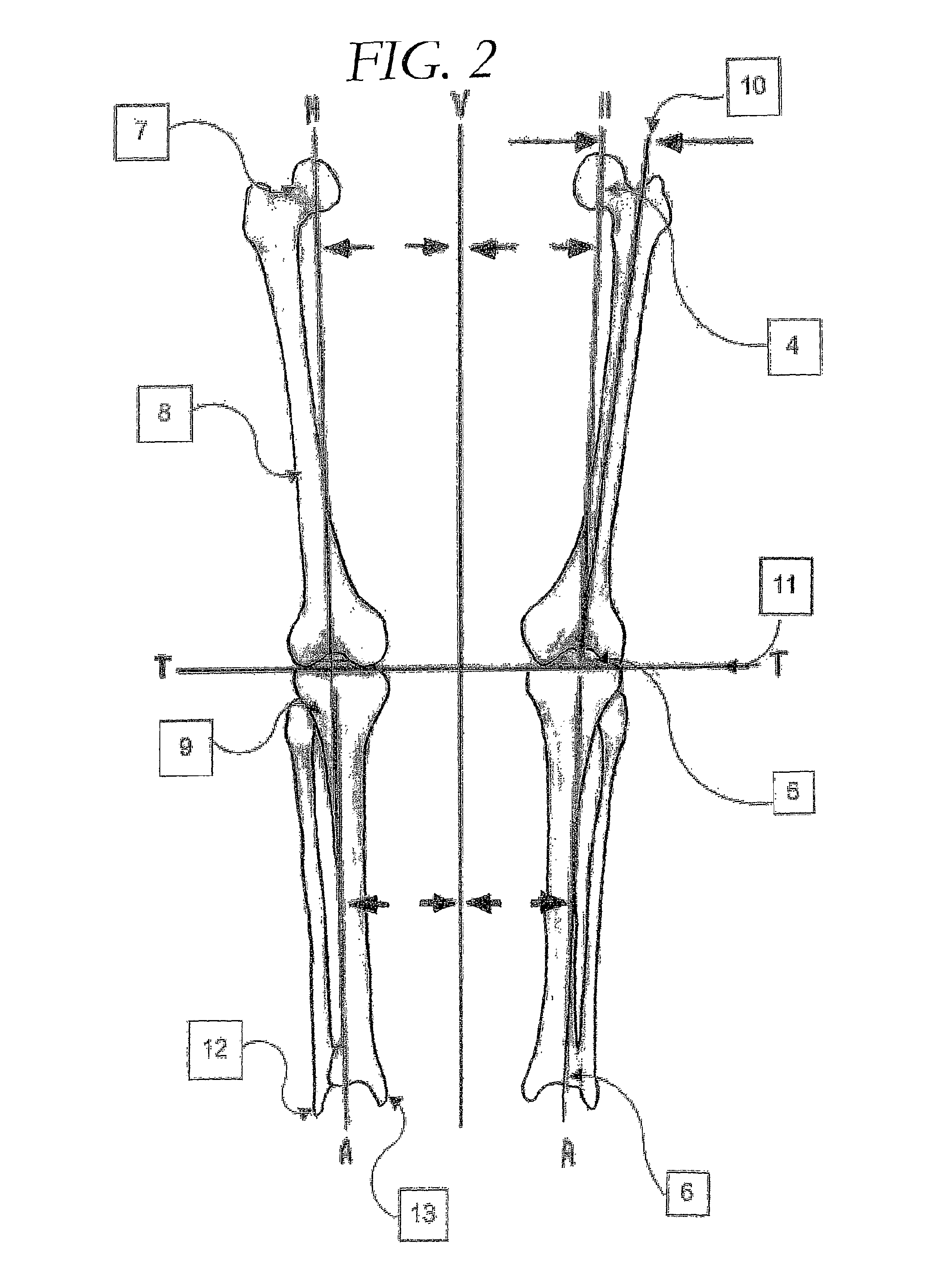 Device and method for assisting the alignment of limbs