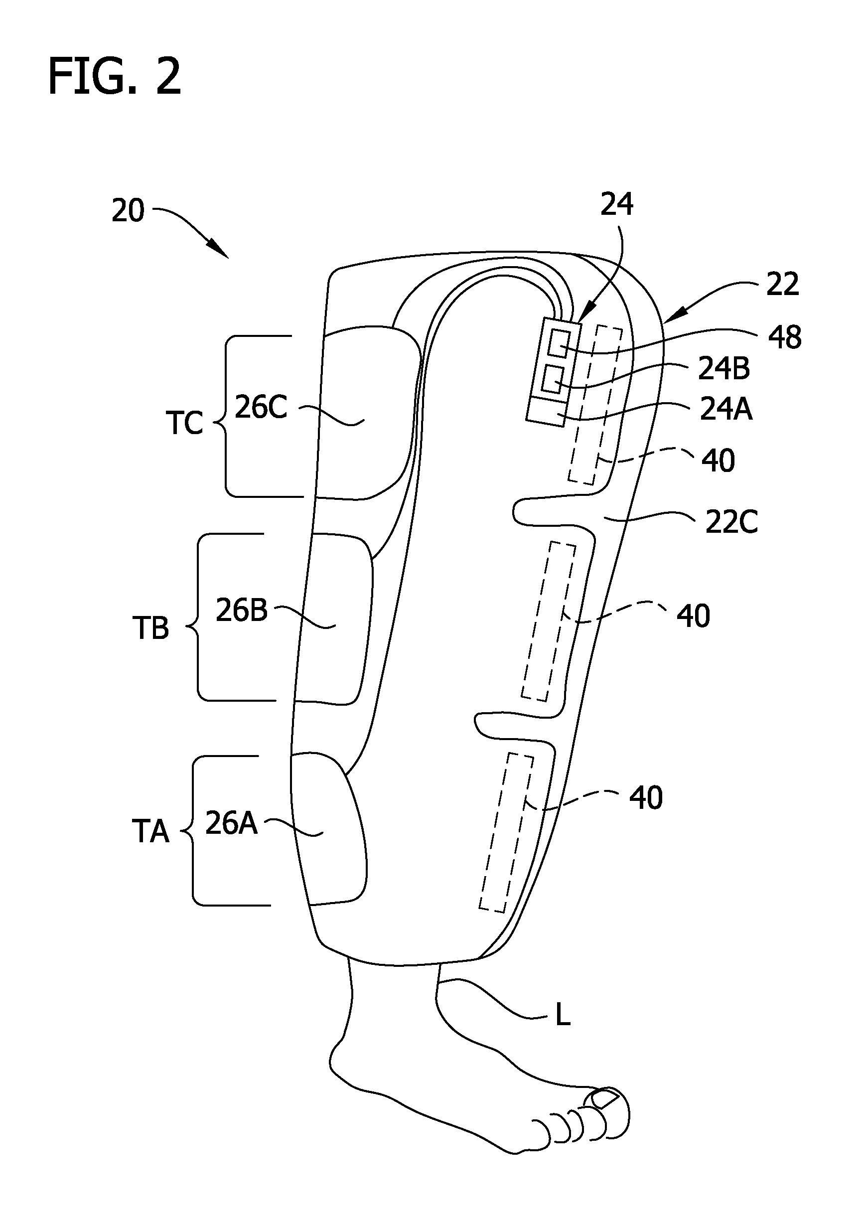 Compression garment apparatus having baseline pressure