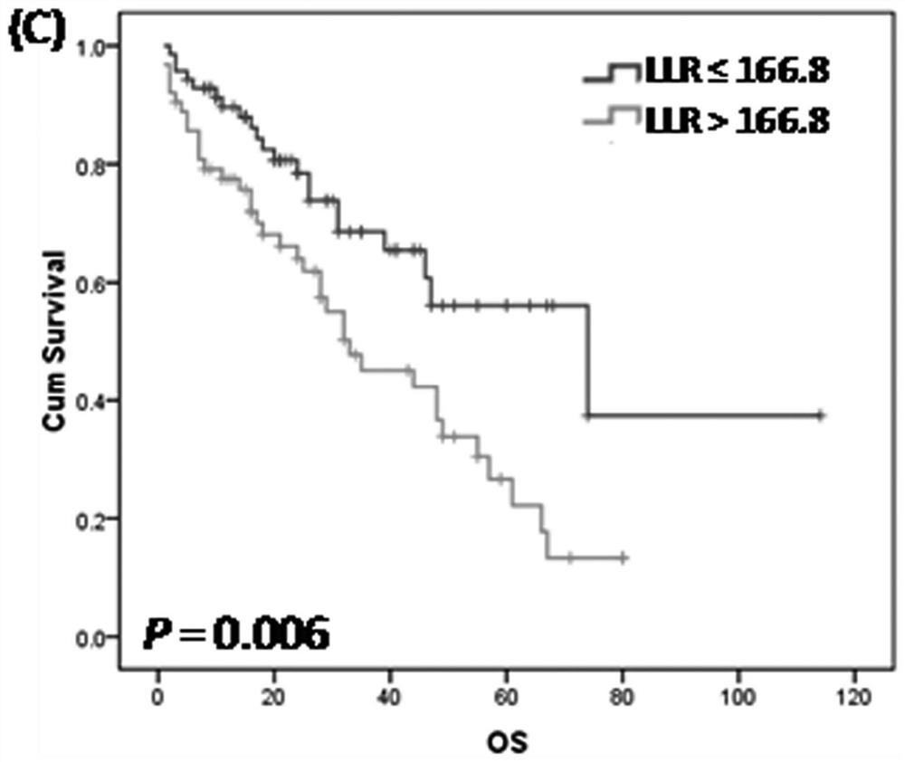 Establishment method and application of primary central nervous system lymphoma prognosis model