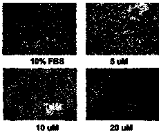 A kind of p-methoxybenzyl-benzamide compound that regulates the activity of estrogen-related receptors and its medical application