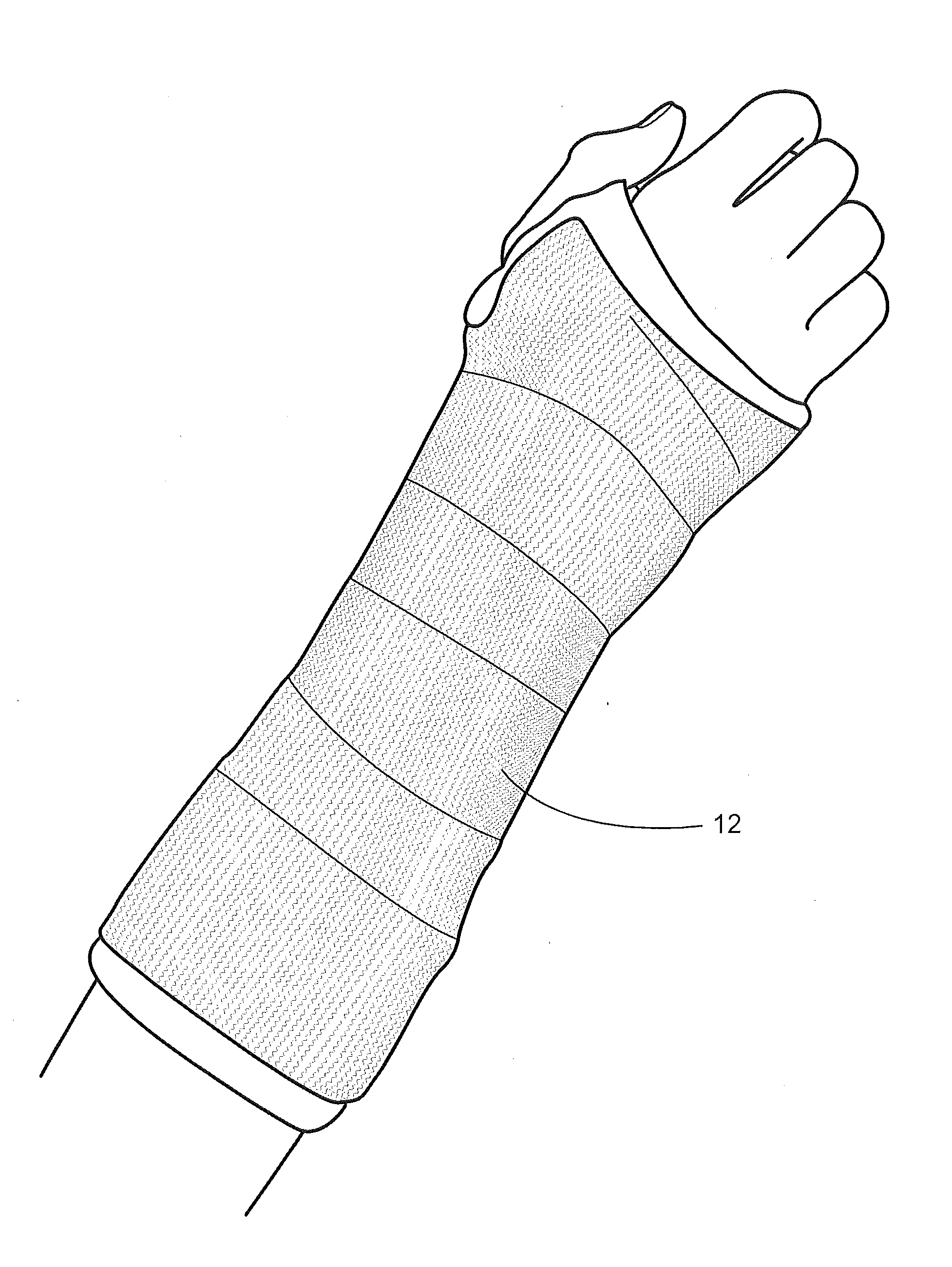 Orthopedic cast and splint bandages with encapsulated hardening medium and method