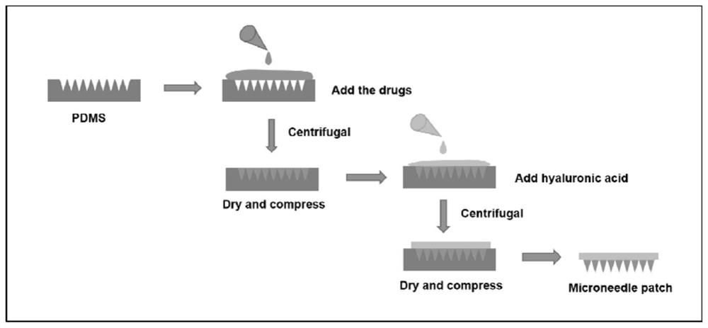 Polymer microneedle patch for treating acne and preparation method of polymer microneedle patch