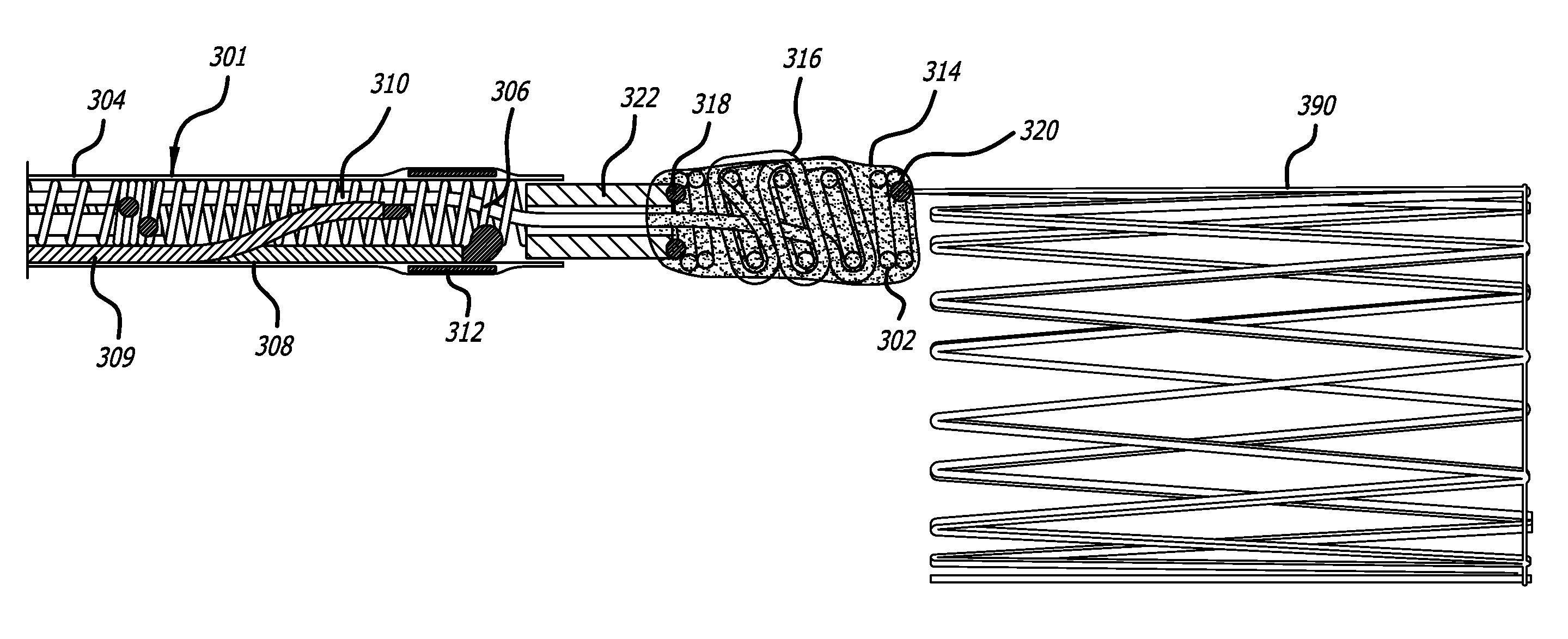 Implant Delivery System