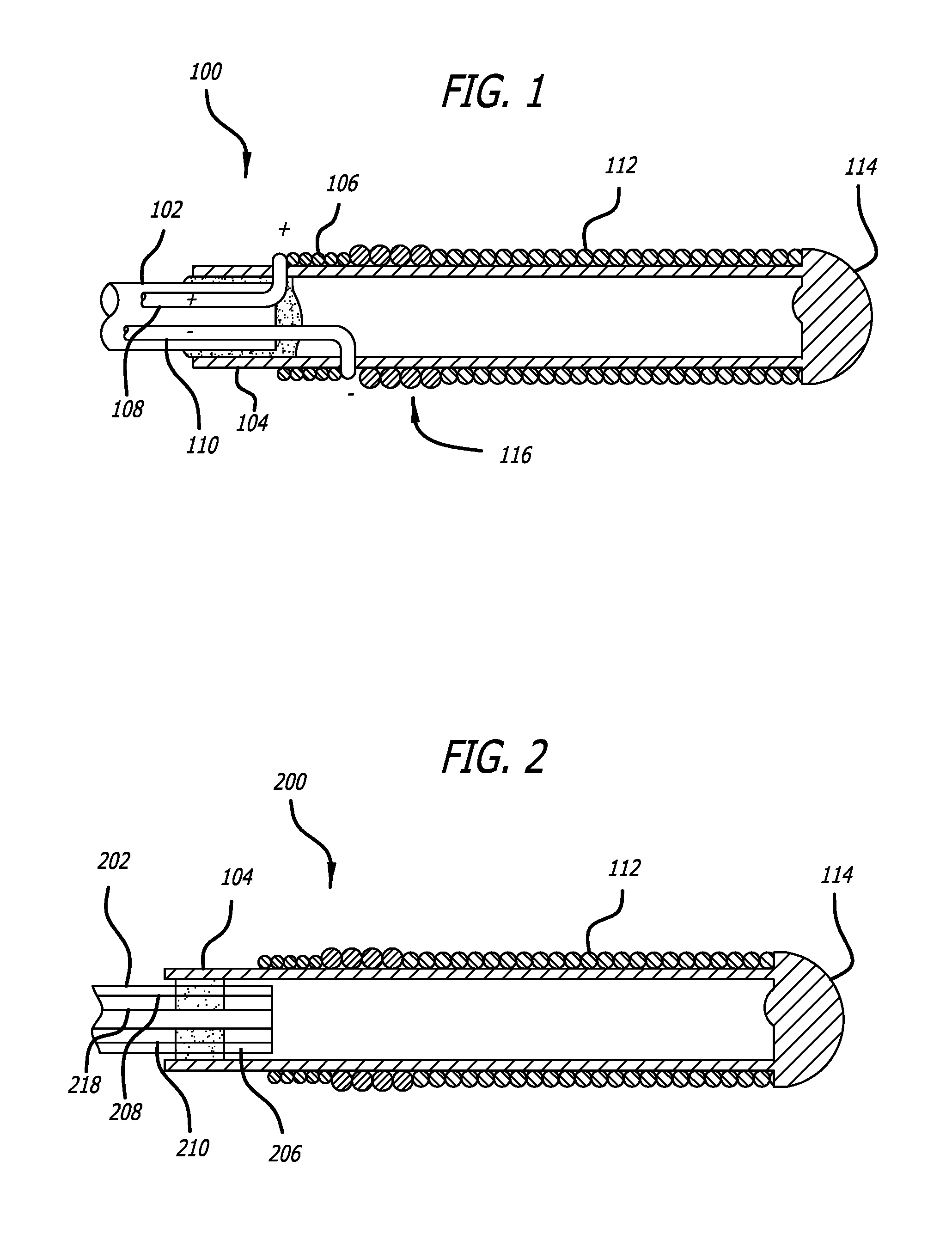 Implant Delivery System