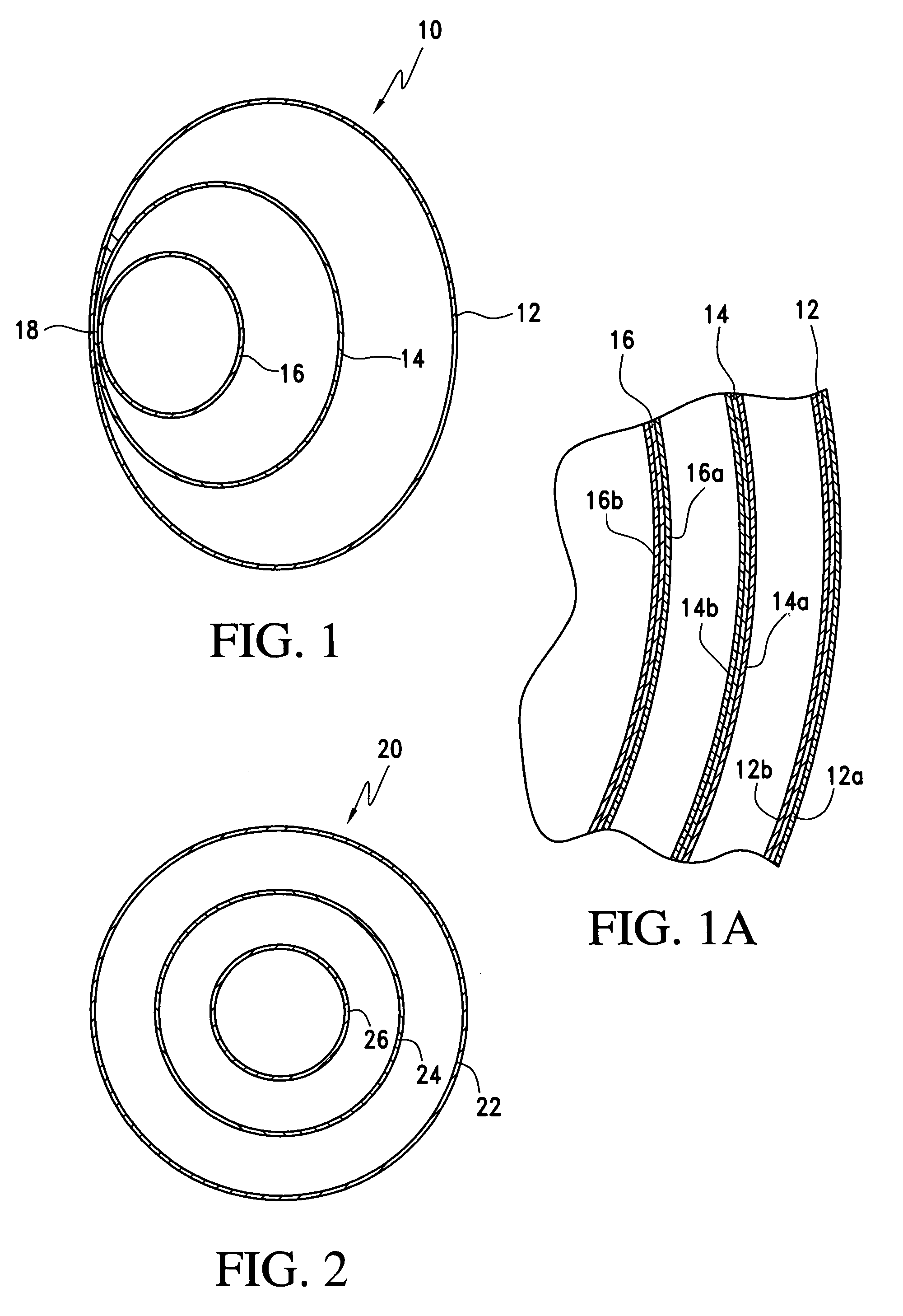 Implant device