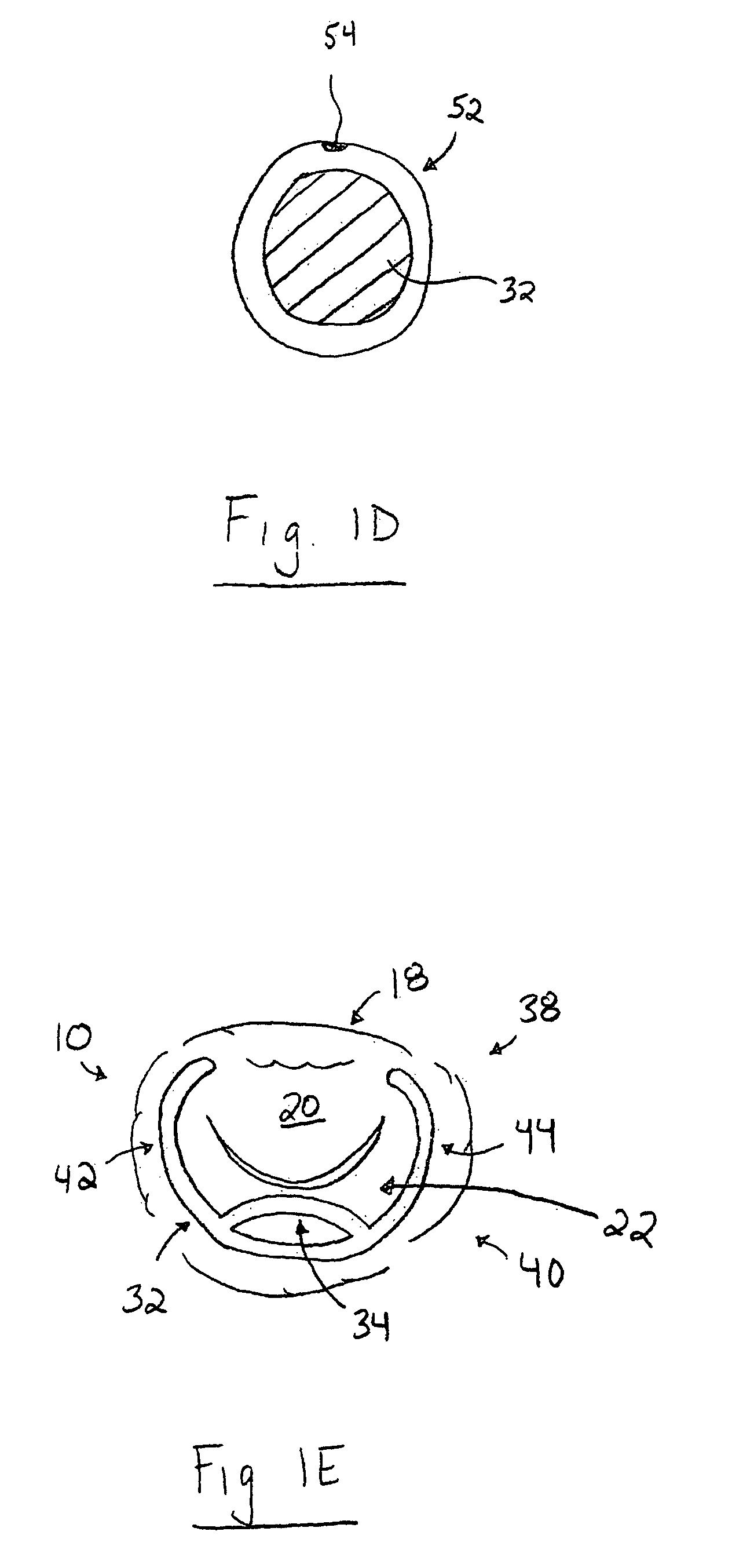 Apparatus and method for treating a regurgitant heart valve