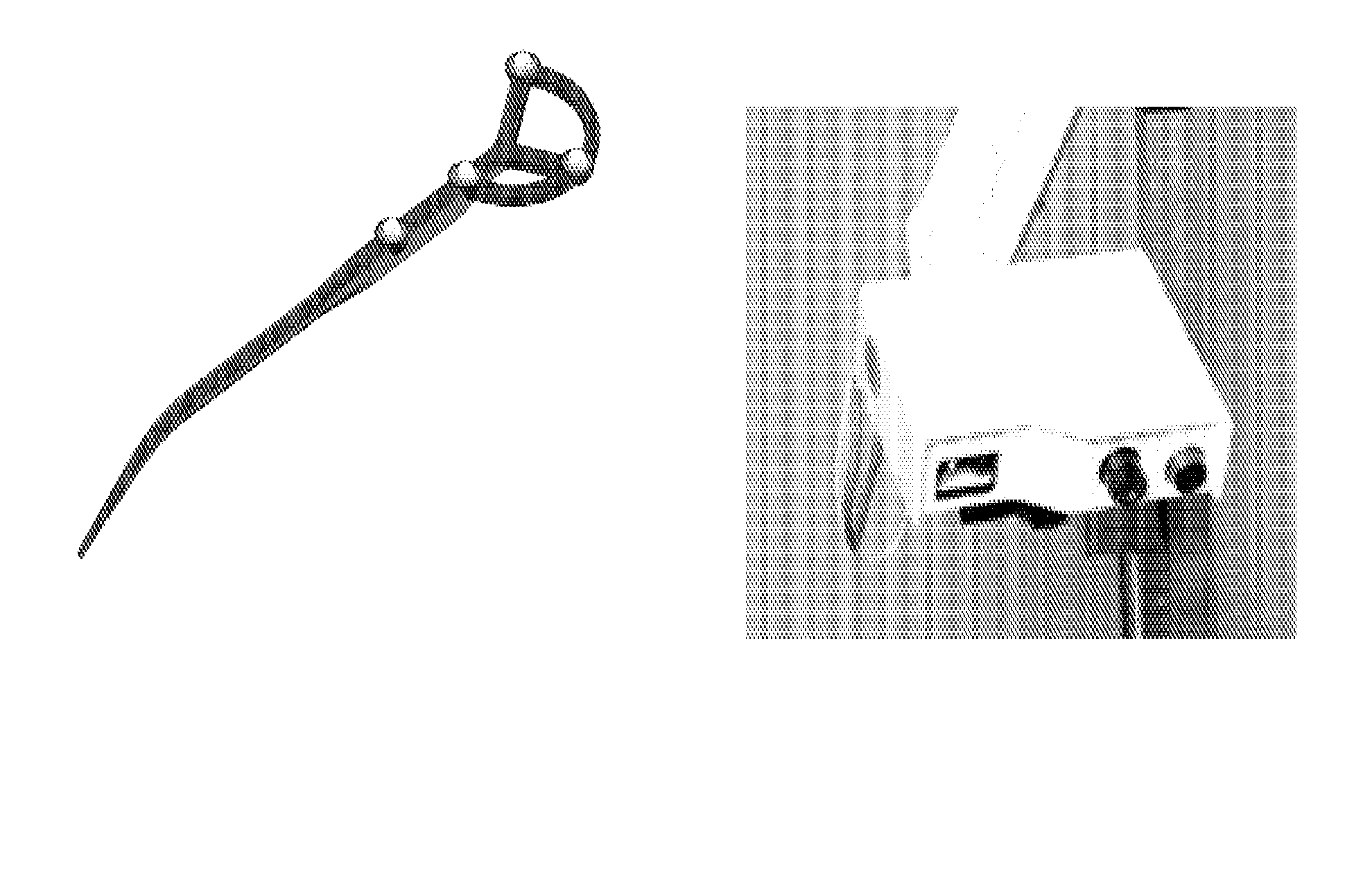 System and method for abdominal surface matching using pseudo-features