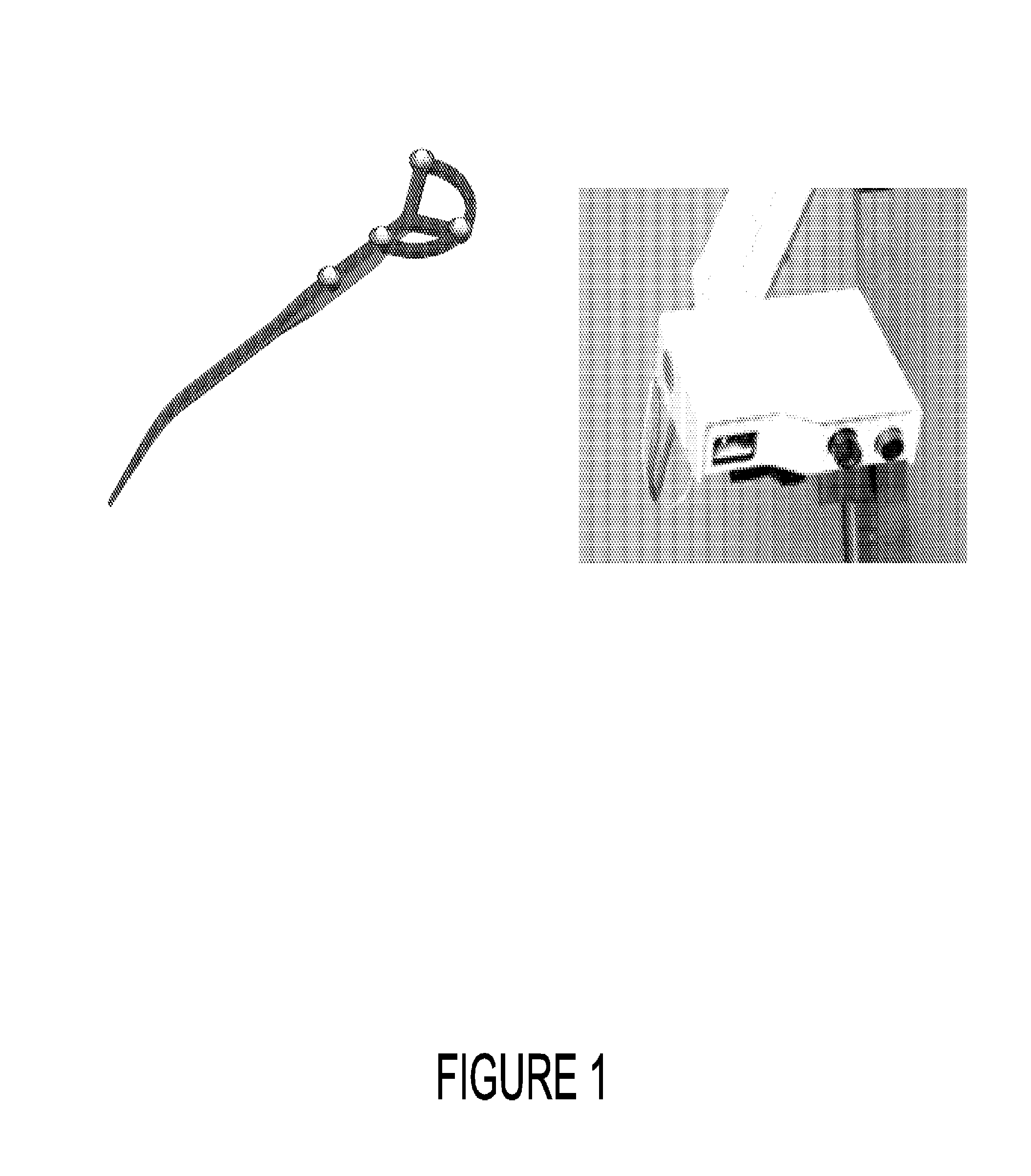 System and method for abdominal surface matching using pseudo-features