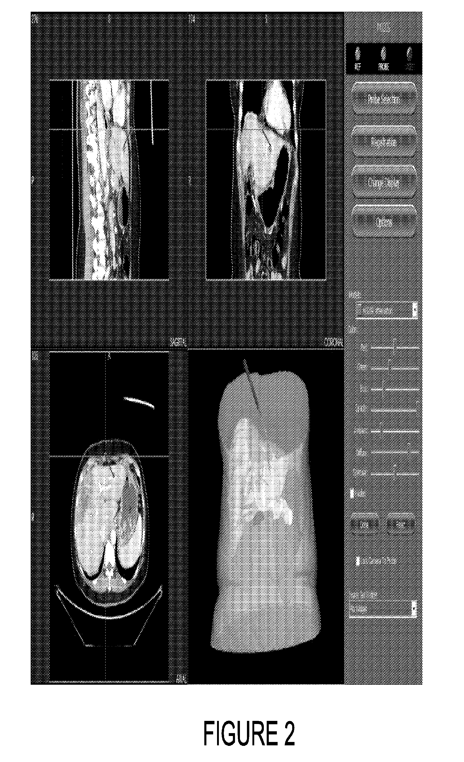 System and method for abdominal surface matching using pseudo-features