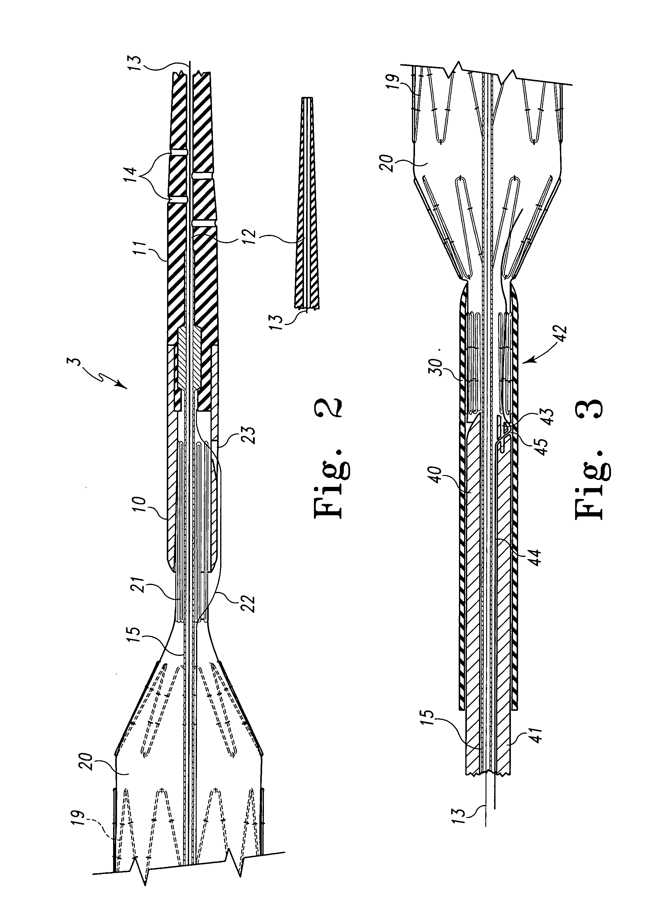Fenestrated intraluminal stent system