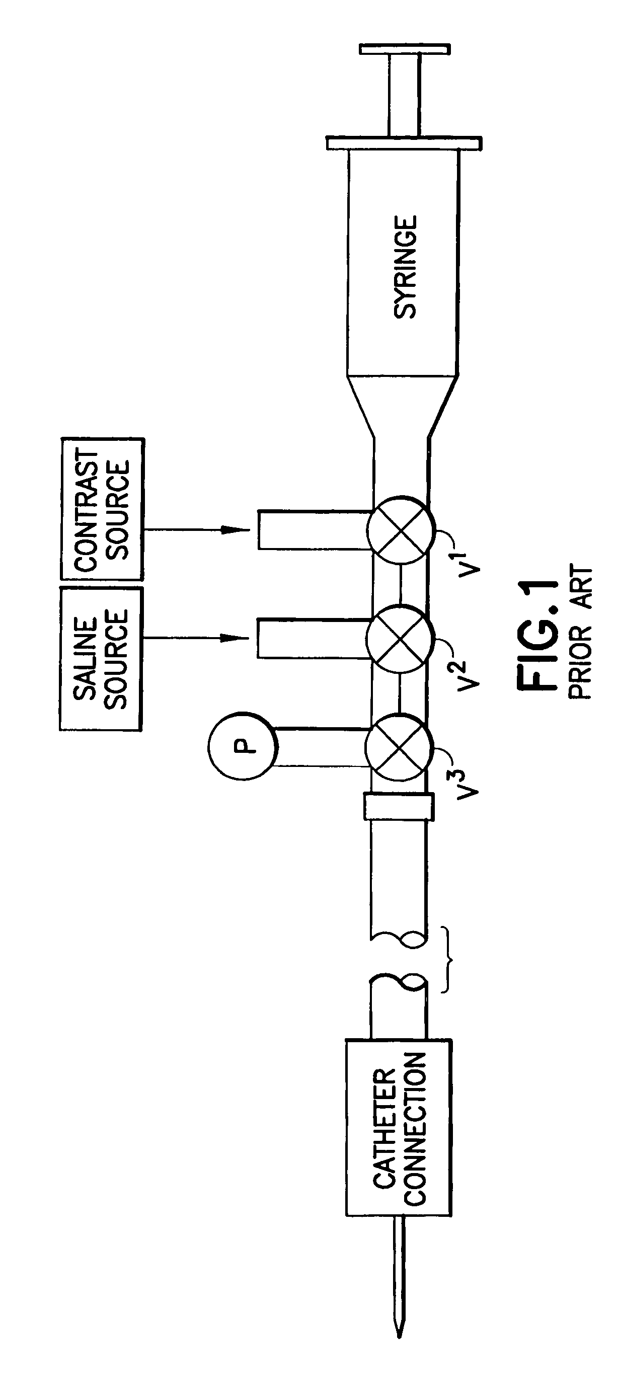 Fluid delivery system having a fluid level sensor and a fluid control device for isolating a patient from a pump device