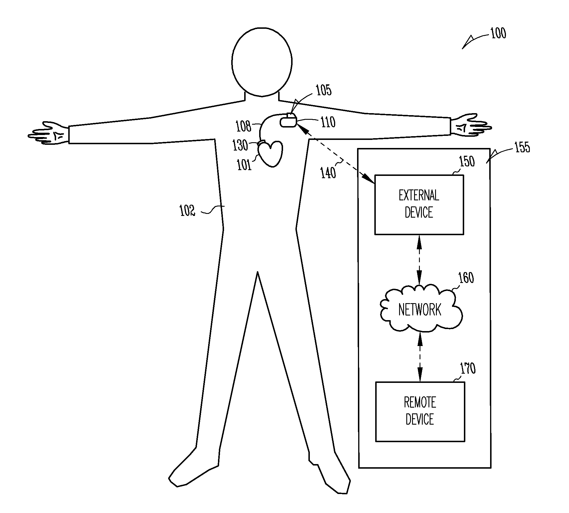 Method for preparing an implantable controlled gene or protein delivery device
