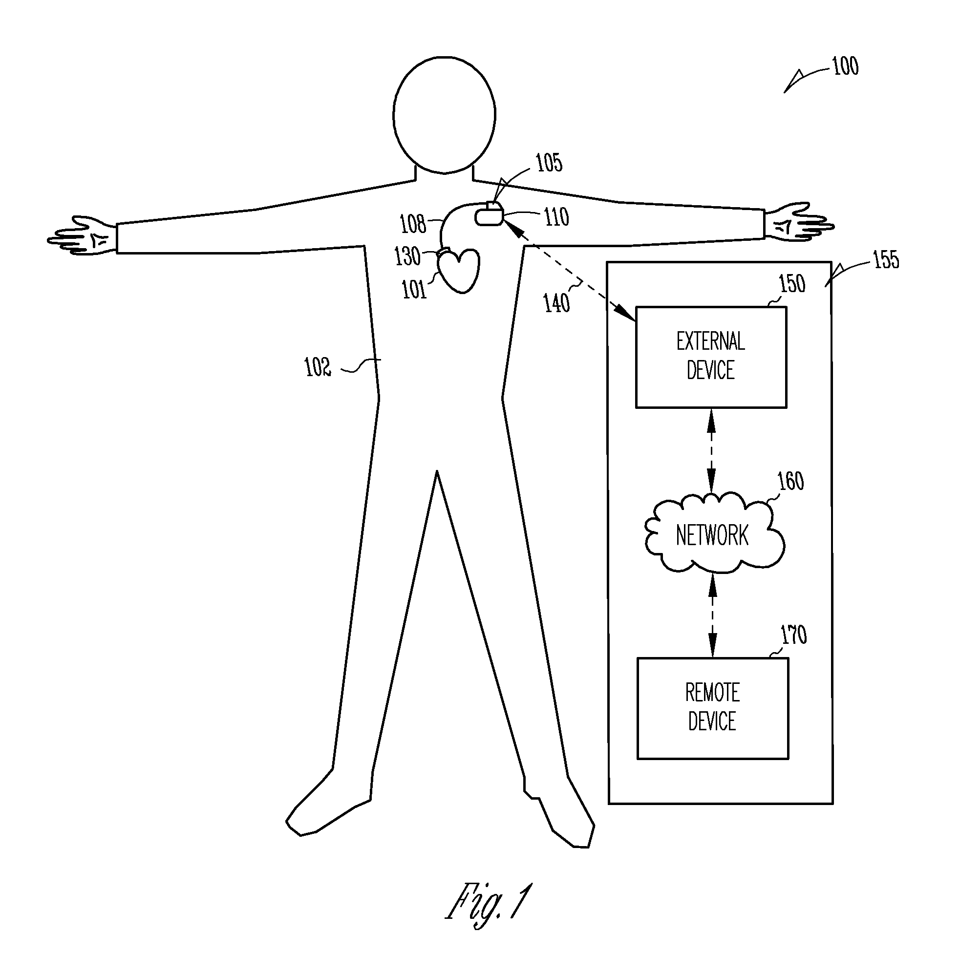 Method for preparing an implantable controlled gene or protein delivery device