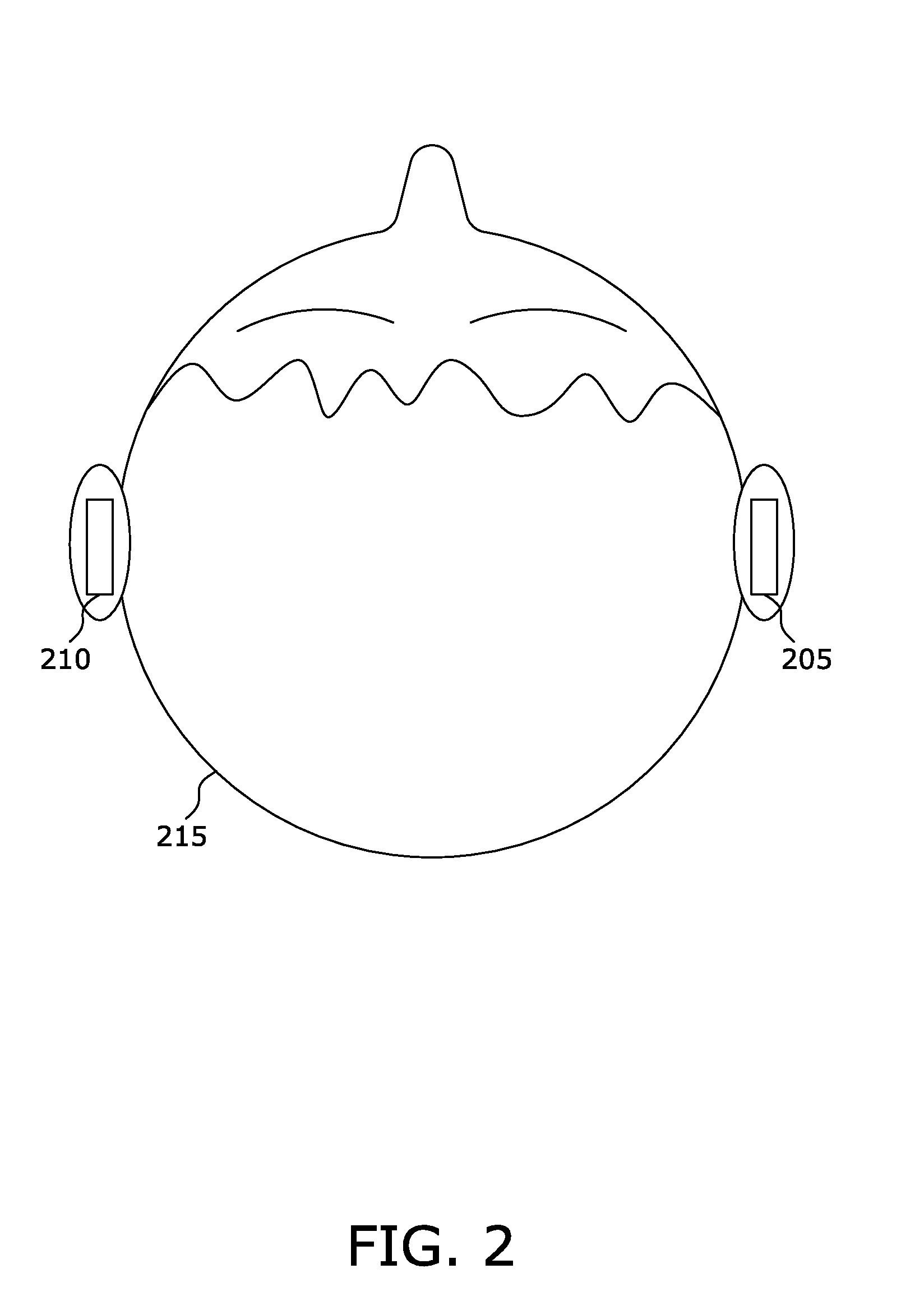 Two Chip Solution Band Filtering