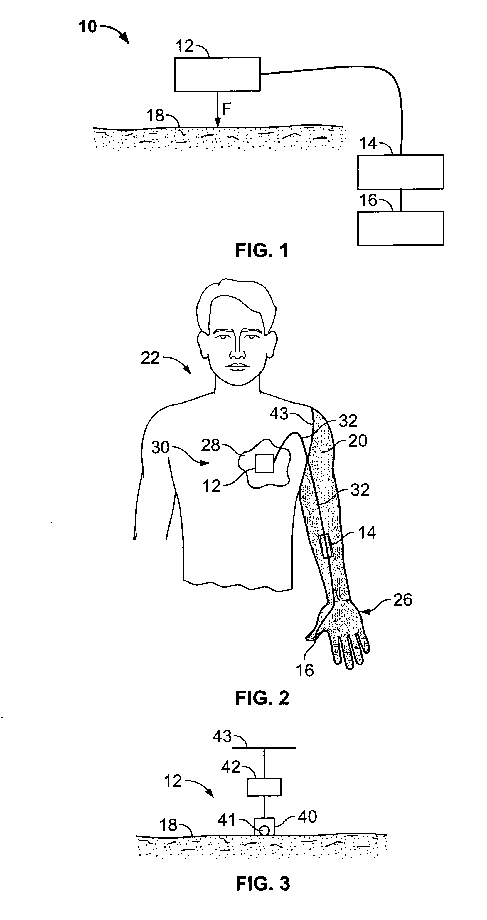 System and method for improving the functionality of prostheses