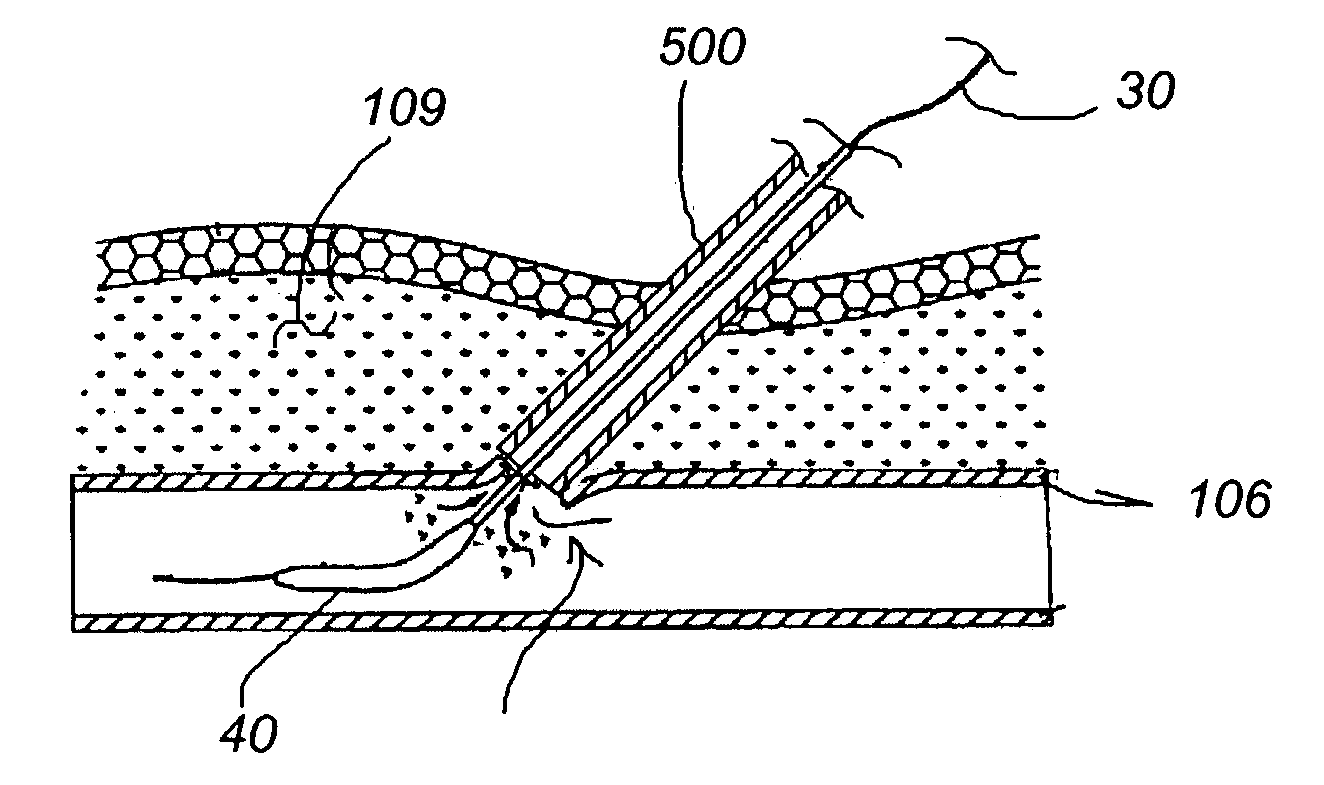 System and method for delivering hemostasis promoting material to a blood vessel puncture site
