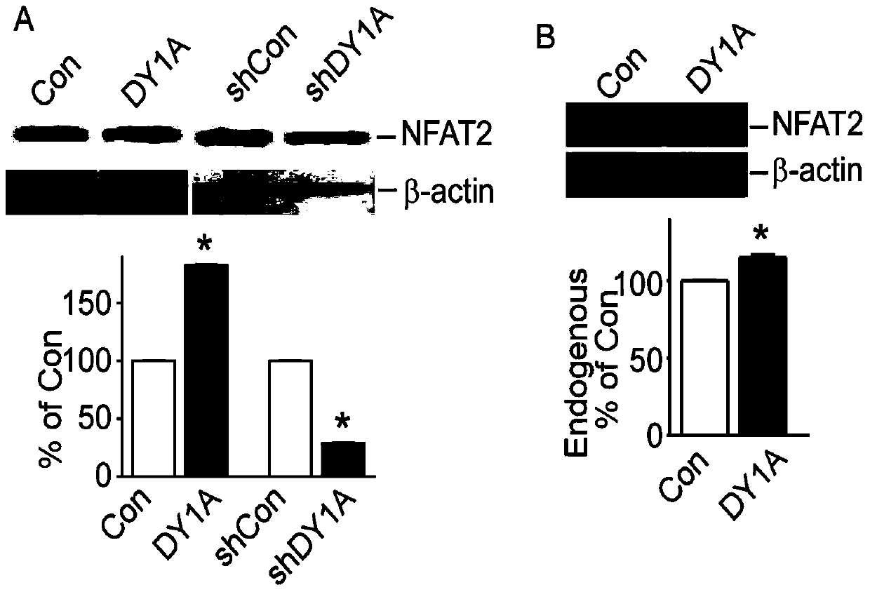 Fusion polypeptide and application of fusion polypeptide in preparing anti-tumor medicines