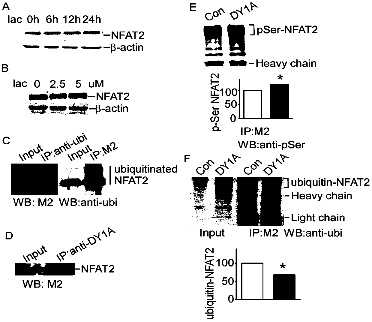 Fusion polypeptide and application of fusion polypeptide in preparing anti-tumor medicines