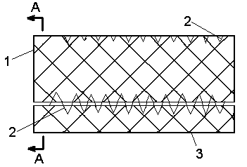 Degradable or detachable digestive tract bracket