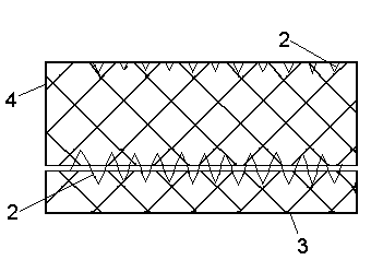 Degradable or detachable digestive tract bracket