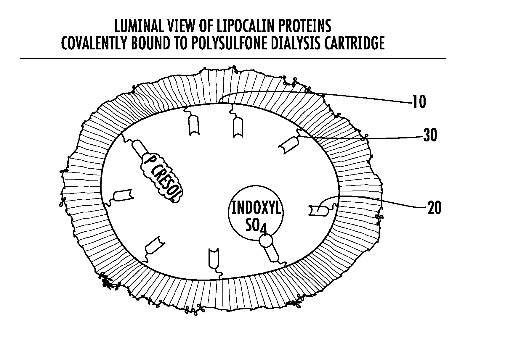 Methods and apparatus for kidney dialysis and extracorporeal detoxification