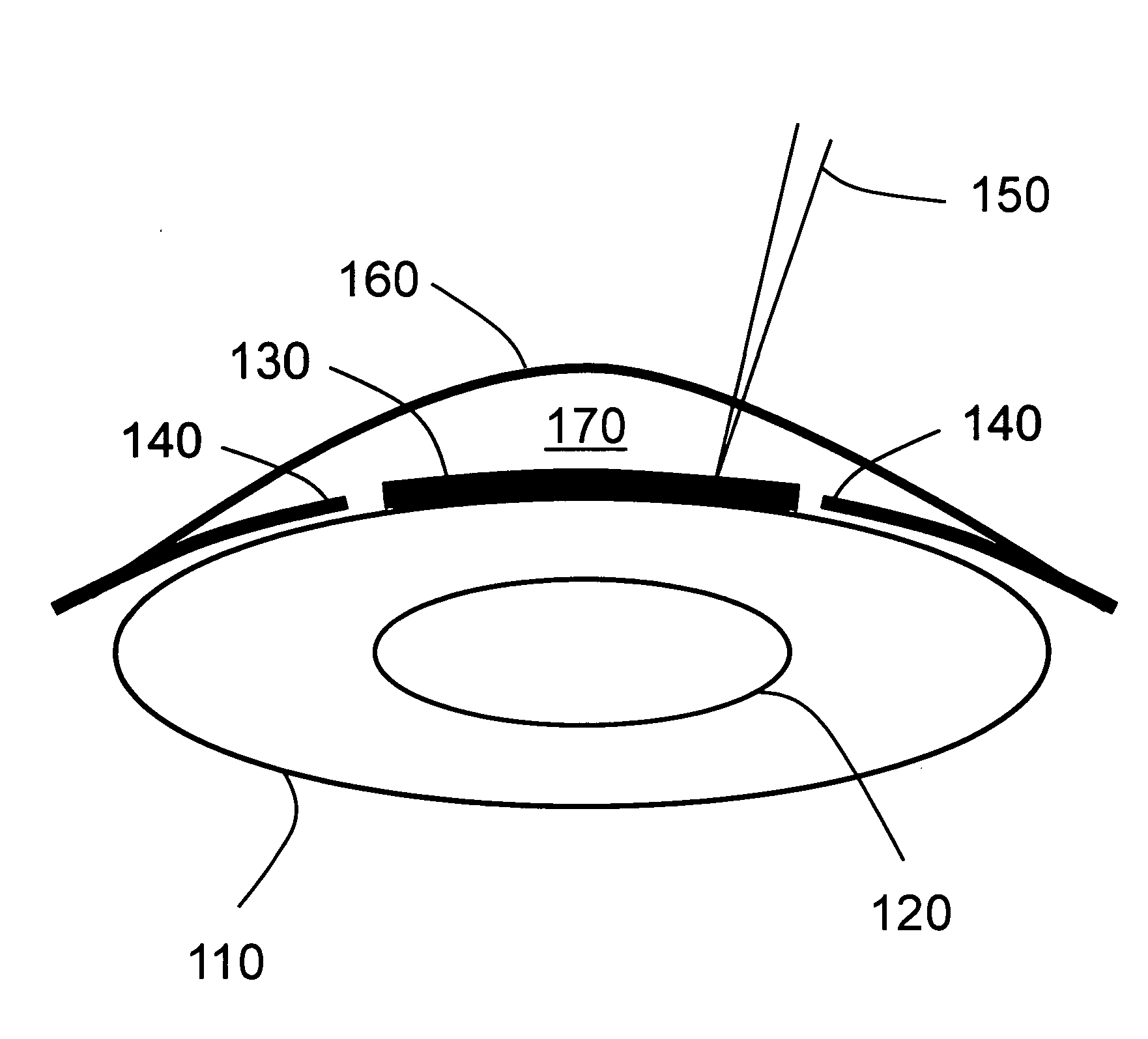 Laser-assisted thermal separation of tissue