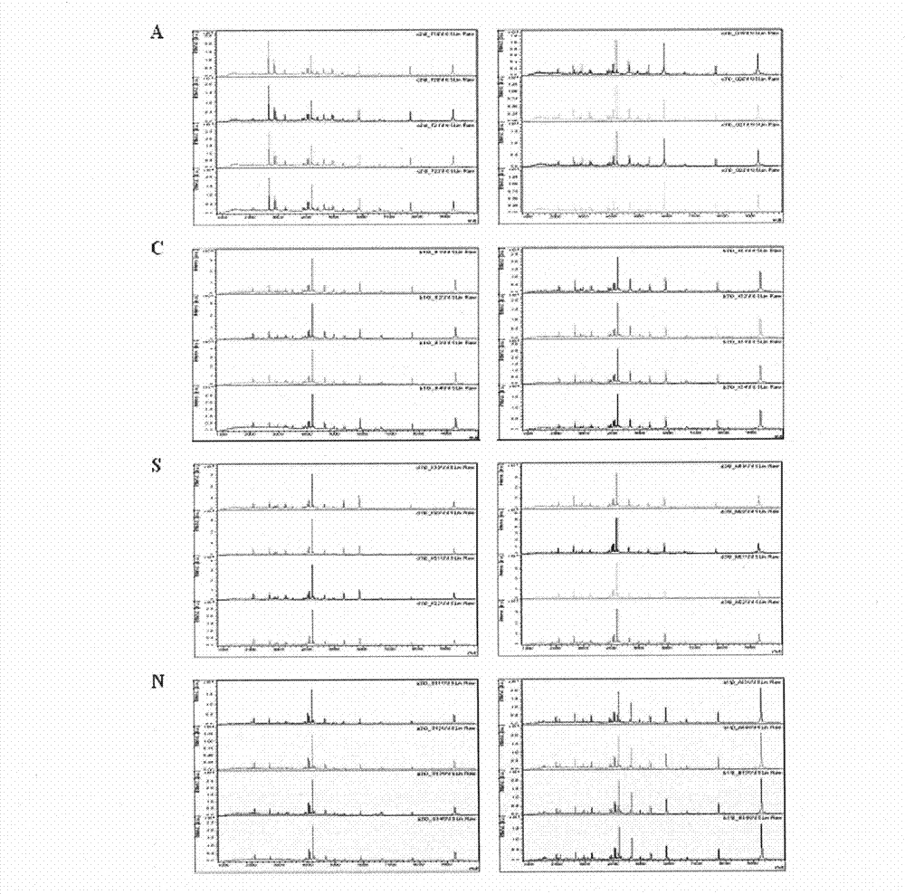 Method for detecting serum polypeptide for kidney transplantation rejection