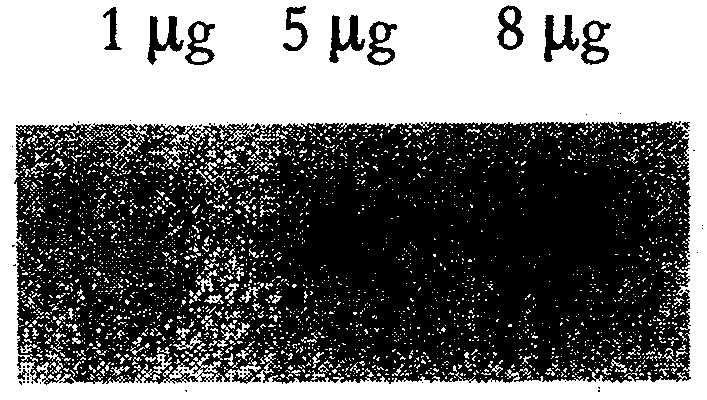 Nucleic acid adaptor for specific identifying human cerebral acetylcholinesterase and its use