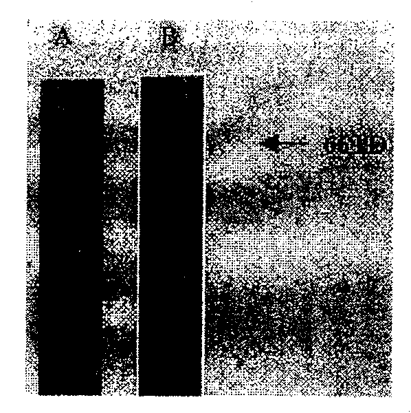 Nucleic acid adaptor for specific identifying human cerebral acetylcholinesterase and its use