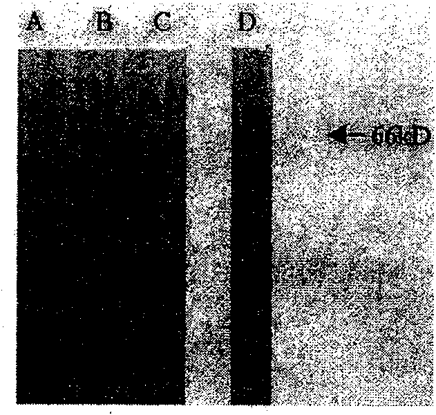 Nucleic acid adaptor for specific identifying human cerebral acetylcholinesterase and its use