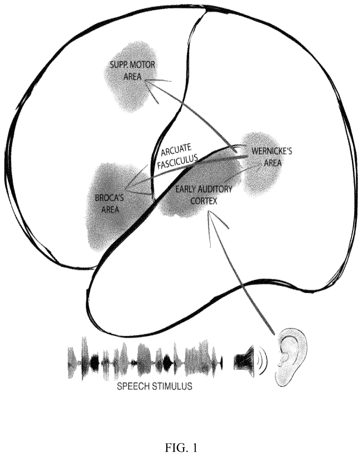 Rapid mapping of language function and motor function without subject participation