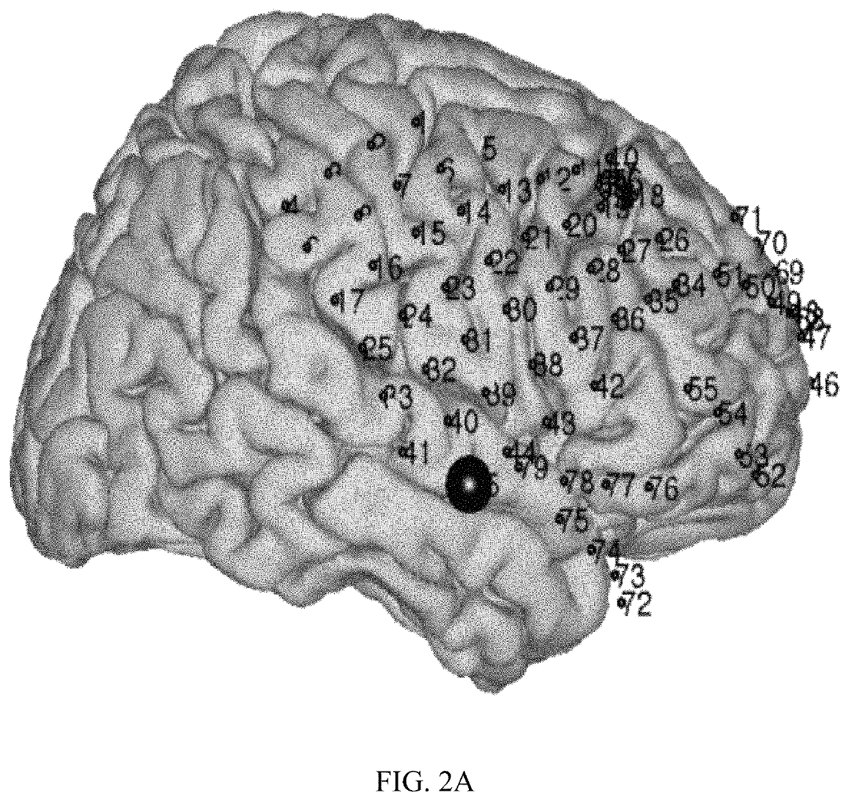 Rapid mapping of language function and motor function without subject participation