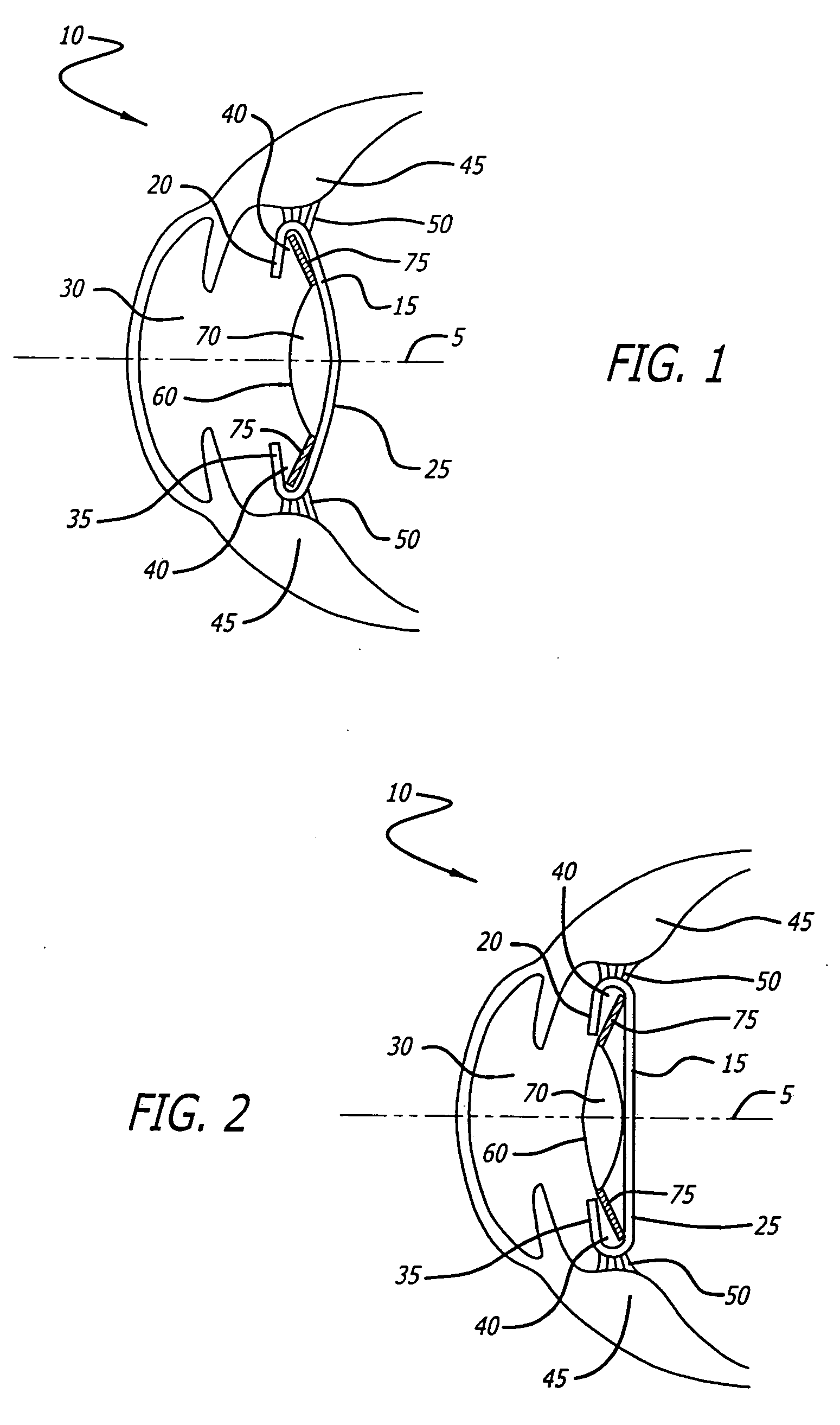 Accommodating intraocular lens with textured haptics
