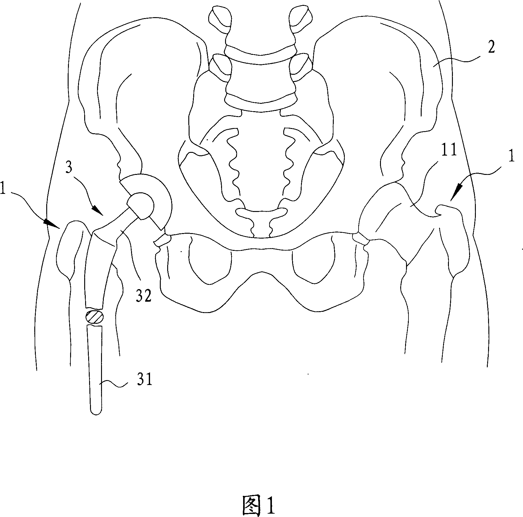 Artificial bone with porous tissue and manufacturing method thereof