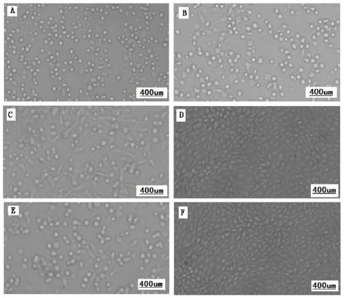 A dual-cell attenuated vaccine for sheep pox and aphthous ulcers and its preparation method and application