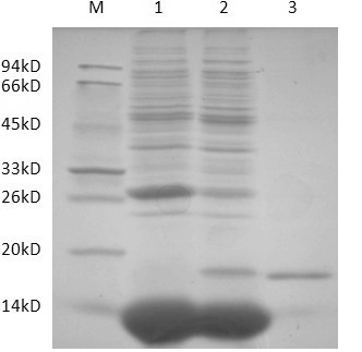 gad gene of porcine globular adiponectin and protein encoded by gad gene and application