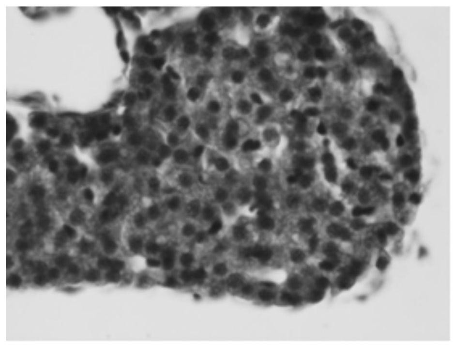 A method for preparing an animal model of liver fibrosis using zebrafish larvae