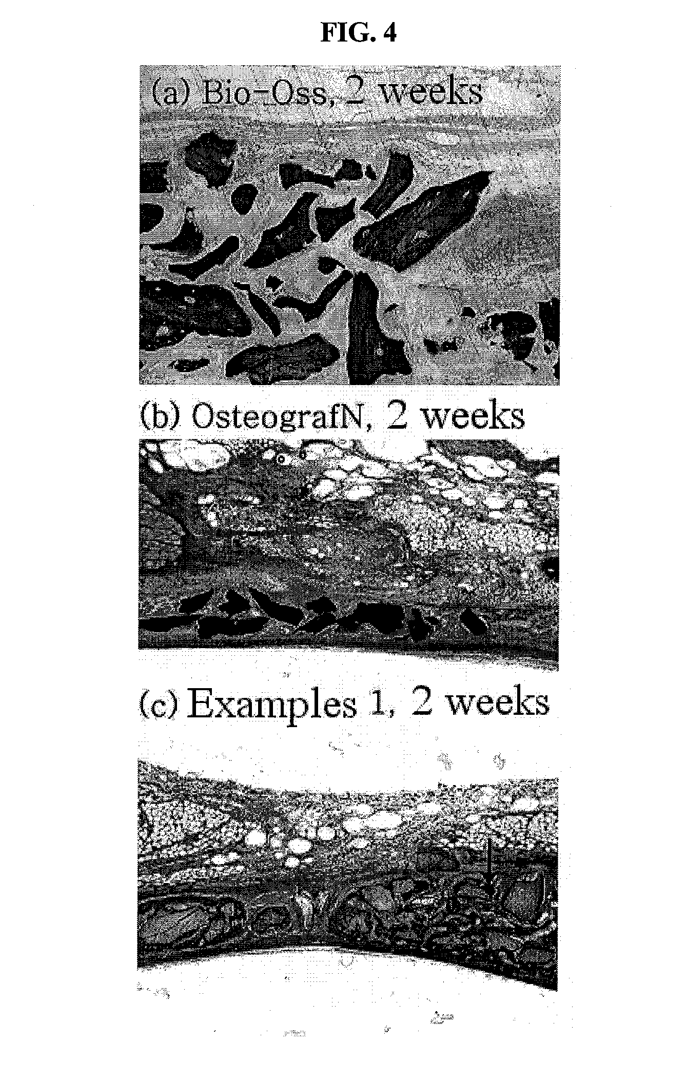 Method for preparing a prion-free bond grafting substitute