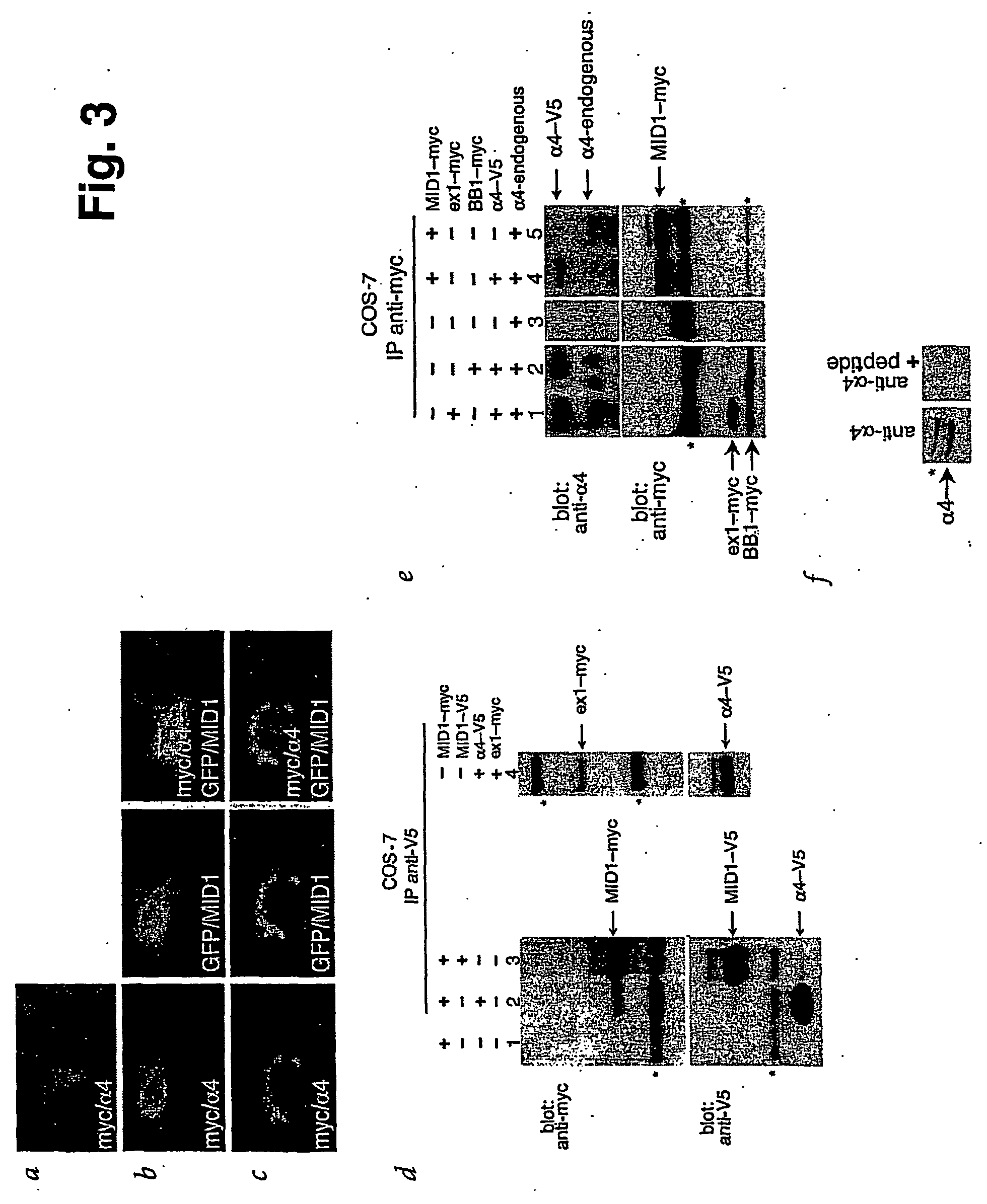 Means for use in treating diseases correlated with or caused by non-physiological levels of microtubule-associated pp2ac