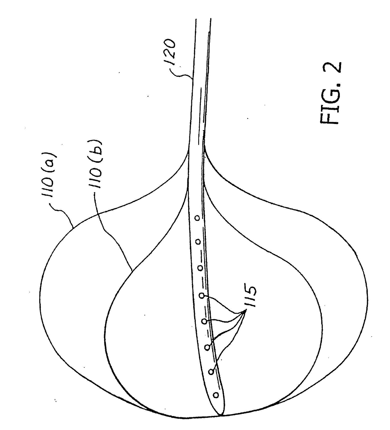 Balloon System and Methods for Treating Obesity