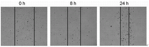 Application of curcumol in intervening endometrial stromal cells